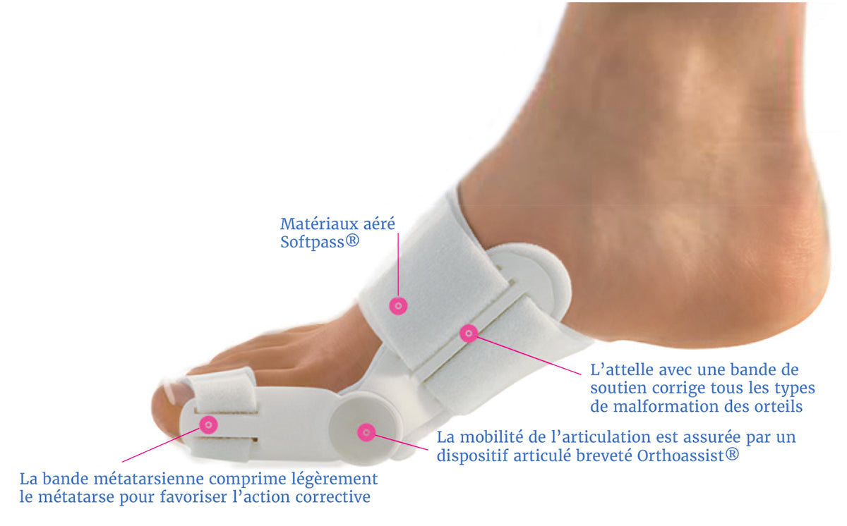 Correcteur de hallux valgus - Soulagement et redressement du gros orteil