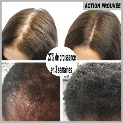 Sérum Roll-On Pousse Cheveux - 1 acheté = 1 offert !