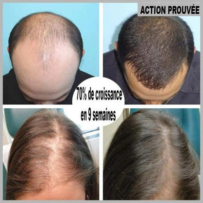 Sérum Roll-On Pousse Cheveux - 1 acheté = 1 offert !