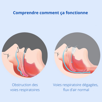 Appareil Buccal Anti-Ronflement pour un Sommeil Revitalisant