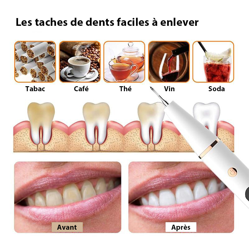 Nettoyeur Dentaire Électronique Sonic LED pour Sourire Éclatant