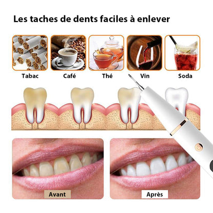 Nettoyeur Dentaire Électronique Sonic LED pour Sourire Éclatant