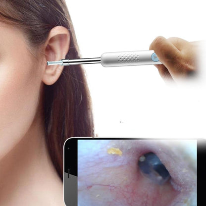 Nettoyeur d'oreilles avec caméra intégrée pour un nettoyage sûr et précis