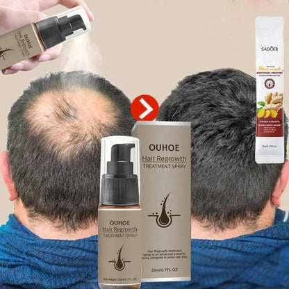Spray Sérum Croissance Cheveux - Vitalité et Éclat pour Tous