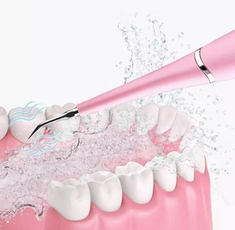 Détartreur Dentaire Électrique : Votre Sourire Éclatant à la Maison !