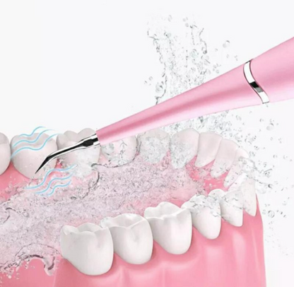 Détartreur Dentaire Électrique : Votre Sourire Éclatant à la Maison !