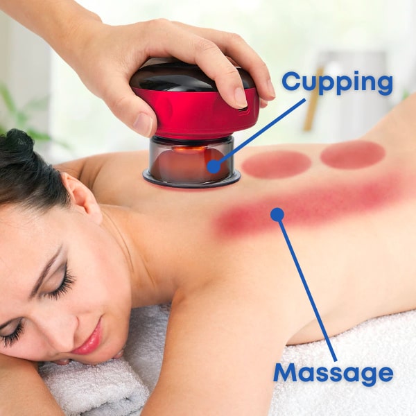 Ventouse Électrique Anti-Cellulite Intelligente avec Chauffage et Luminothérapie