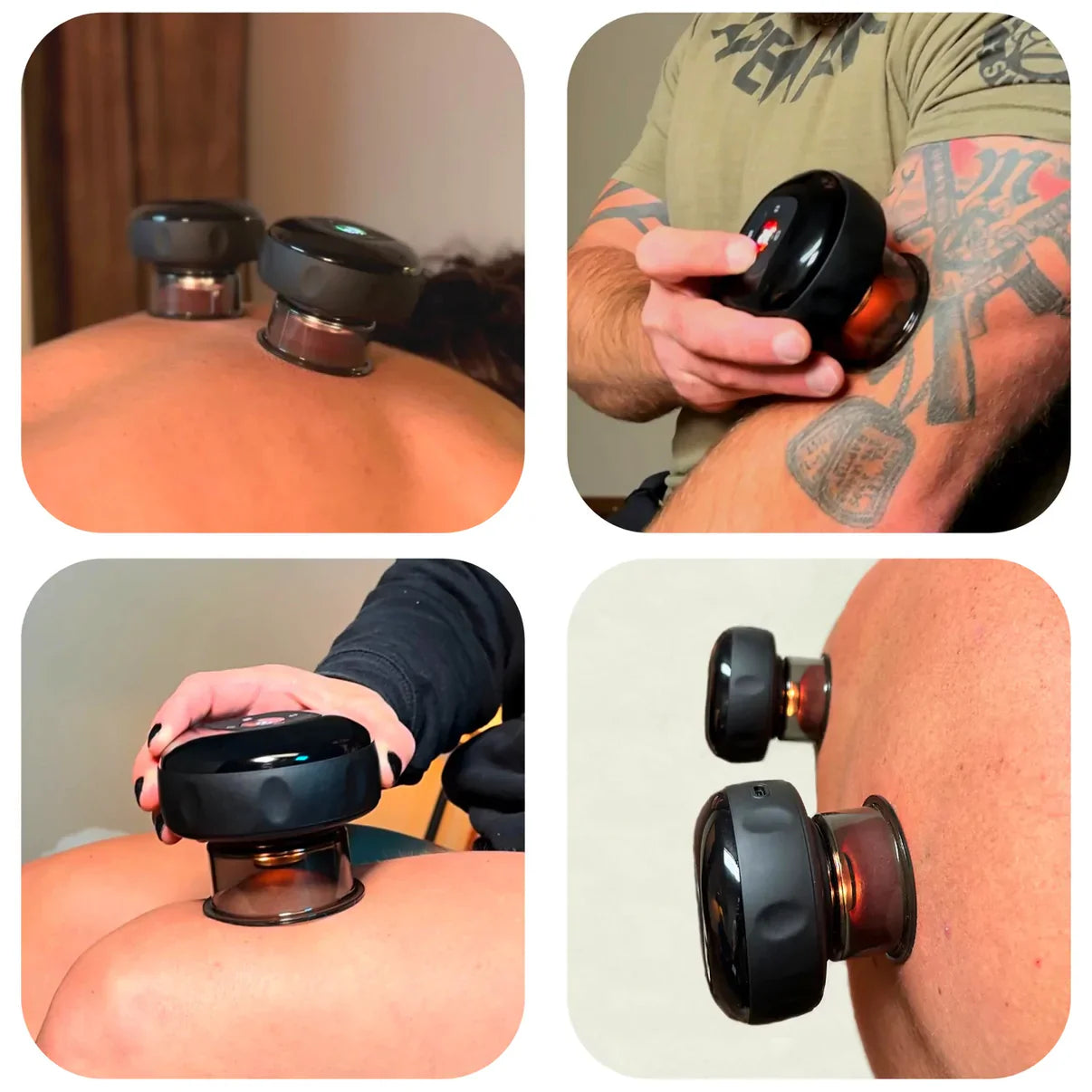 Ventouse Électrique Anti-Cellulite Intelligente avec Chauffage et Luminothérapie