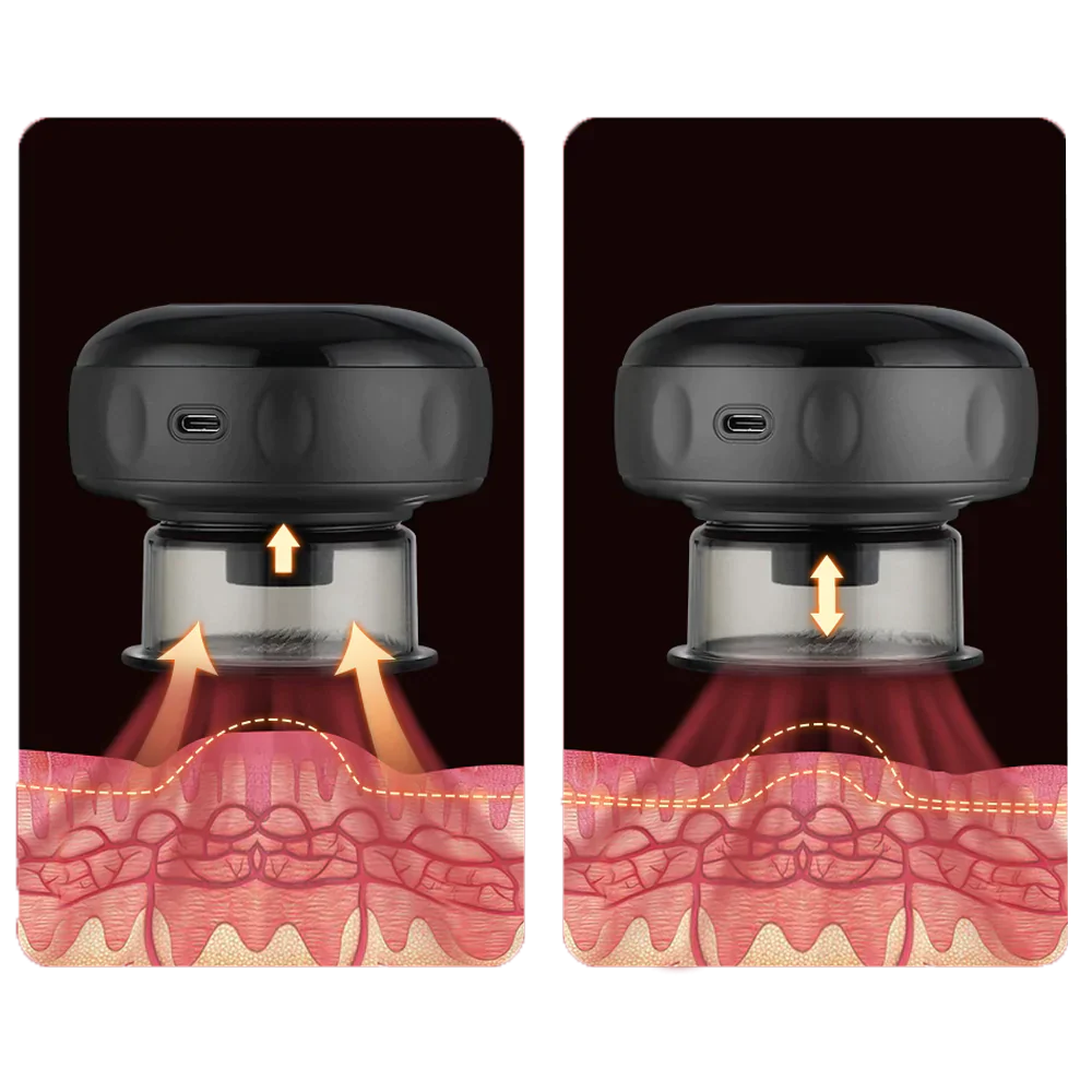 Ventouse Électrique Anti-Cellulite Intelligente avec Chauffage et Luminothérapie