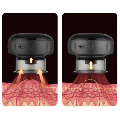 Ventouse Électrique Anti-Cellulite Intelligente avec Chauffage et Luminothérapie