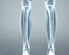 Mocassins orthopédiques en cuir Maddy : confort et style au quotidien